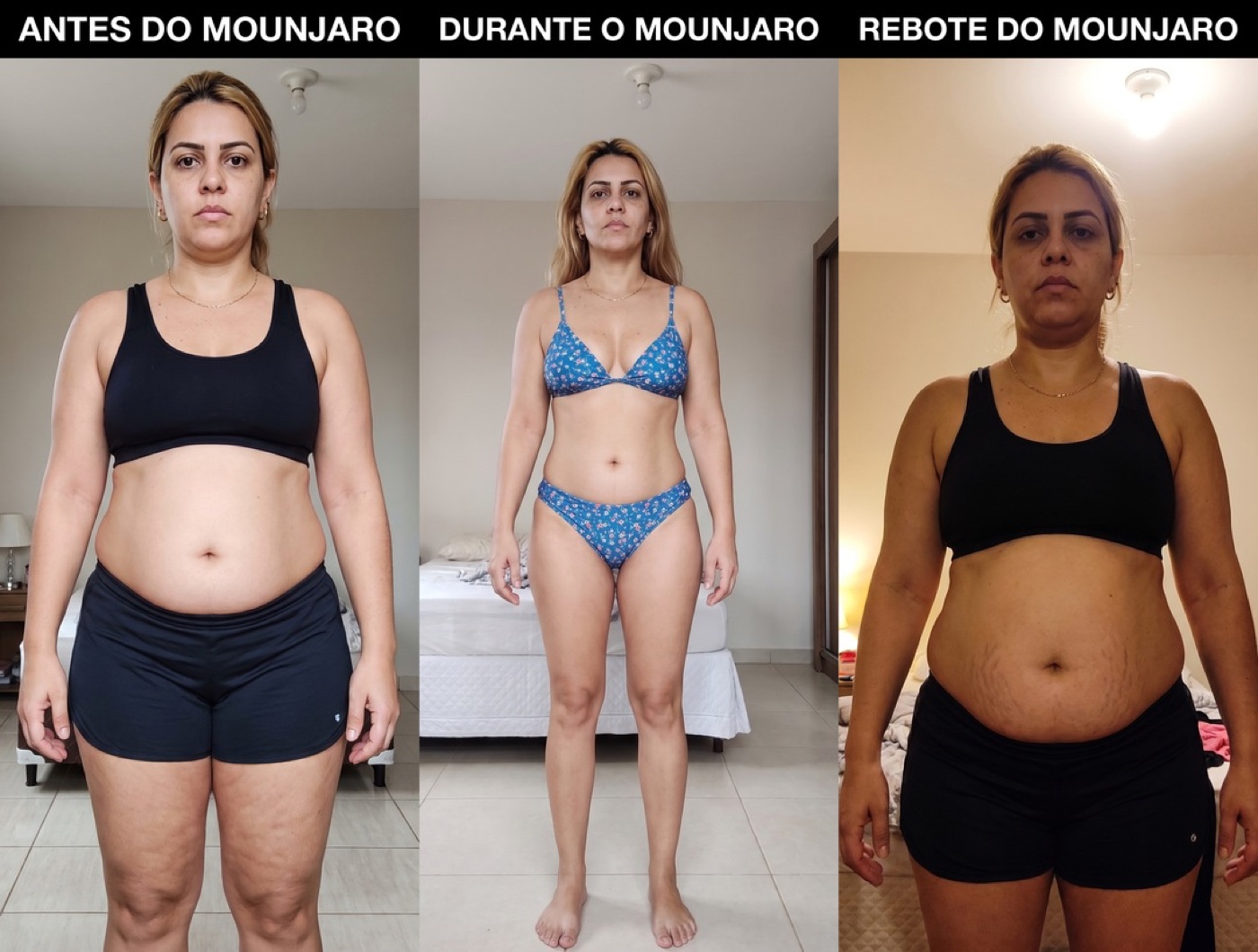 Antes e depois: paciente que saiu da caneta